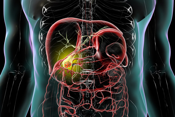 What Happens During Gallbladder Surgery?