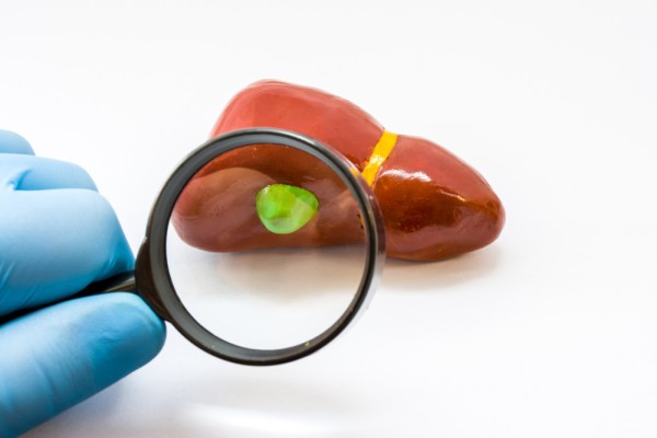 How To Prepare For Gallstone Removal