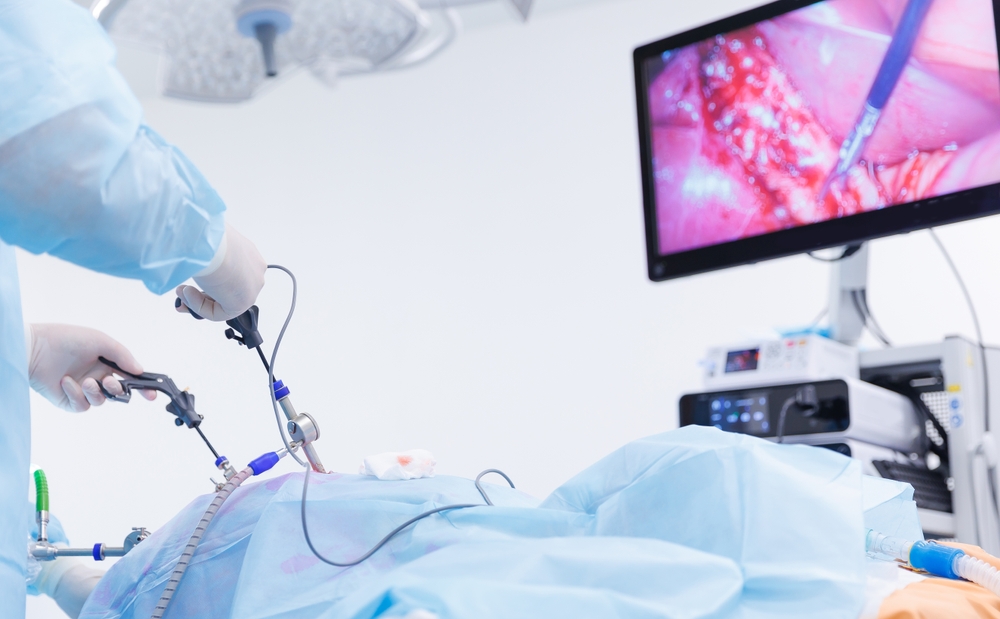 Benefits Of Laparoscopic Surgery